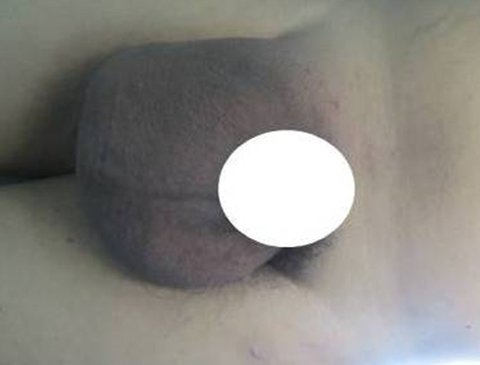 Rounded Image