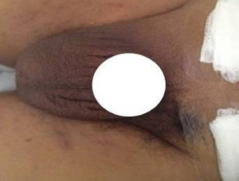 Rounded Image