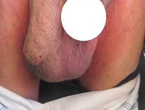 Rounded Image