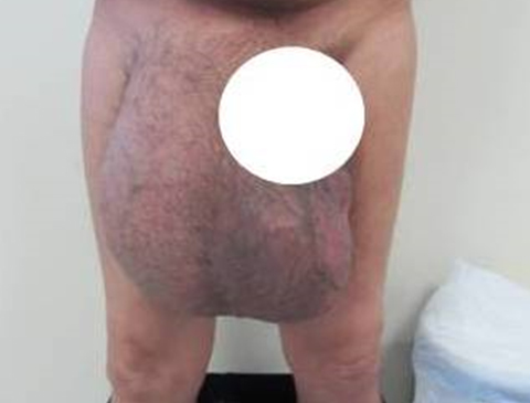 Rounded Image