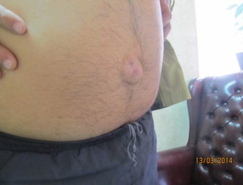 Rounded Image