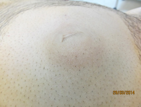 Rounded Image