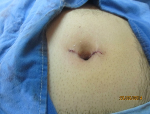 Rounded Image