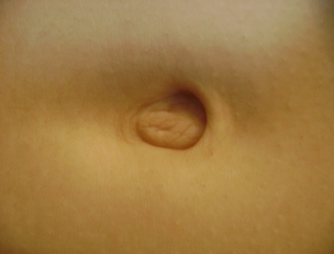Rounded Image