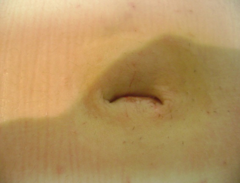 Rounded Image